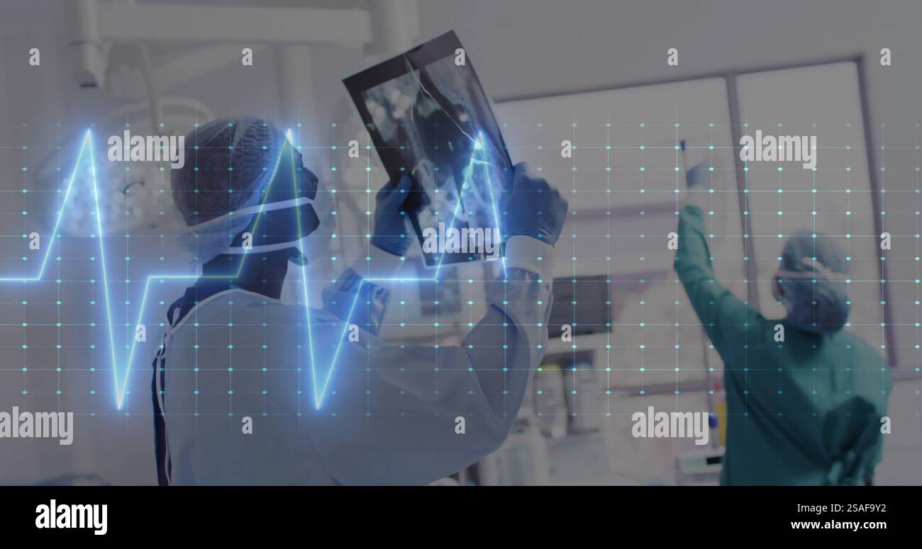 Image of cardiograph over diverse doctors inspecting xray Stock Photo ...
