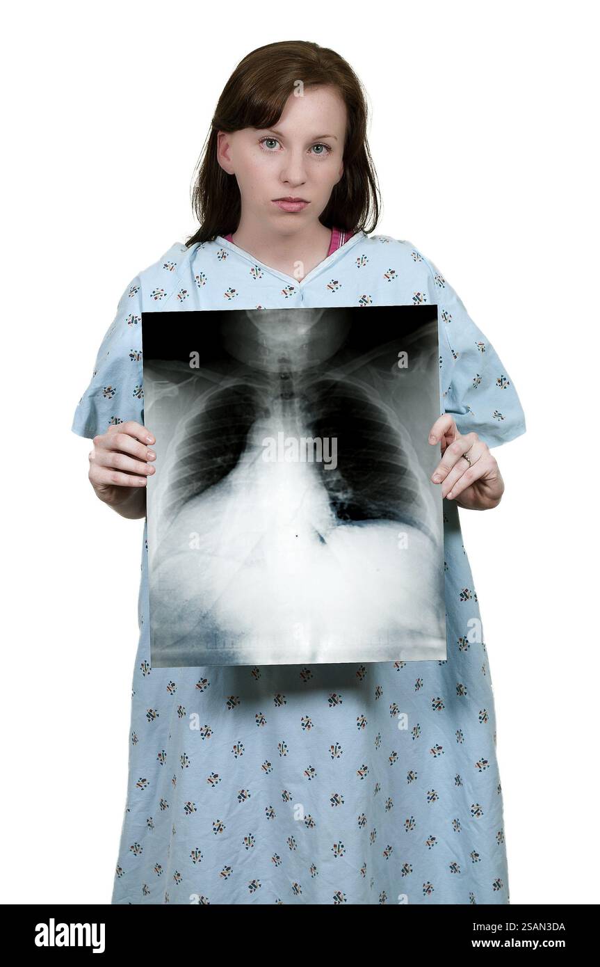 Chest x ray images hi-res stock photography and images - Alamy