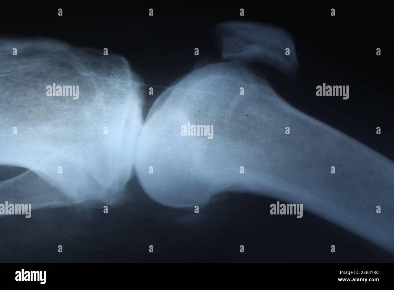X-ray image of knee joint as background, closeup Stock Photo - Alamy