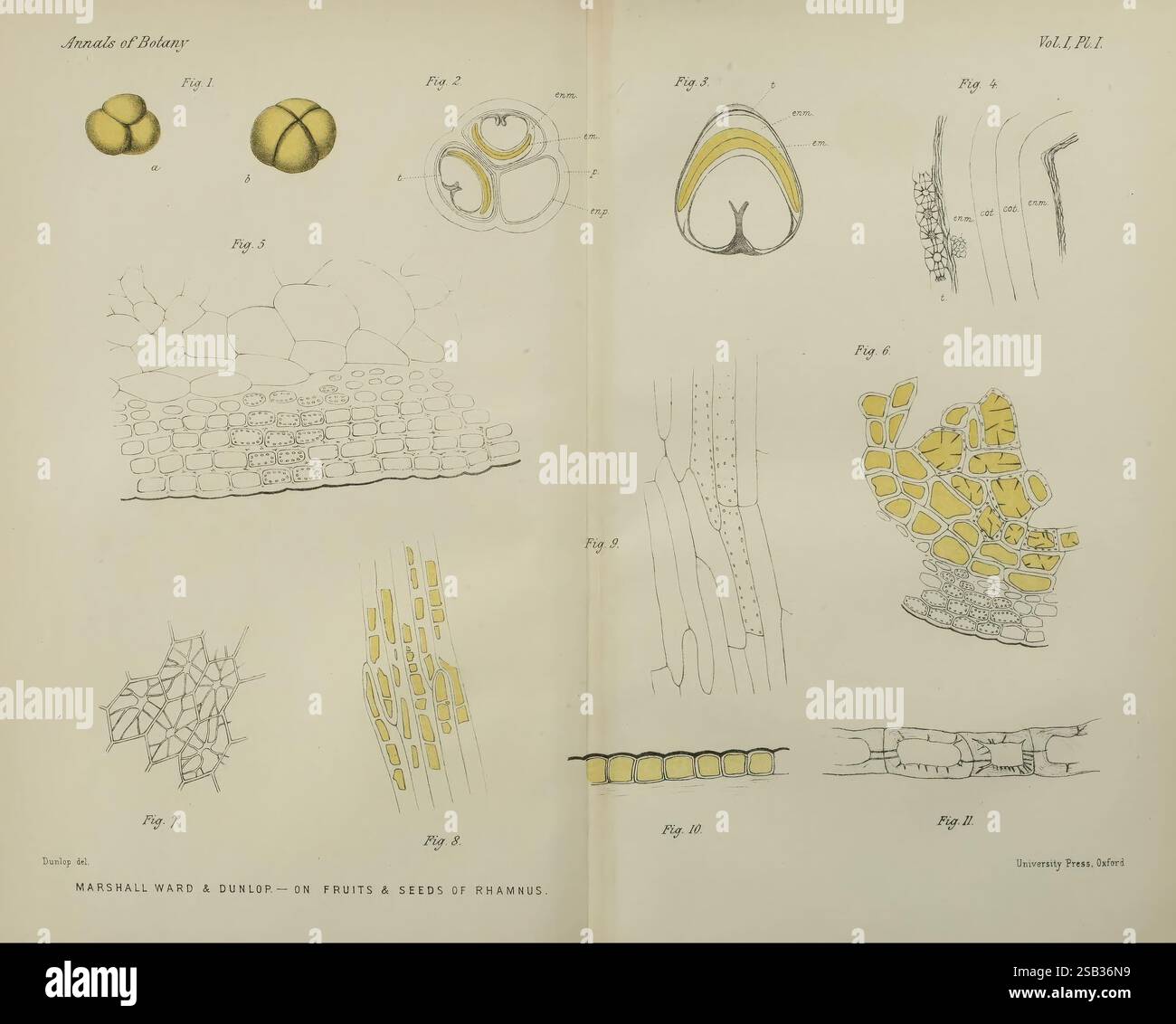 Elements of plant anatomy;. Botany -- Anatomy. ANATOMY OF THE CELL. 17 V. A  form similar to the fourth, but the scakiriform thick- enings are somewhat  irregular. Examples : Reticulated ducts.