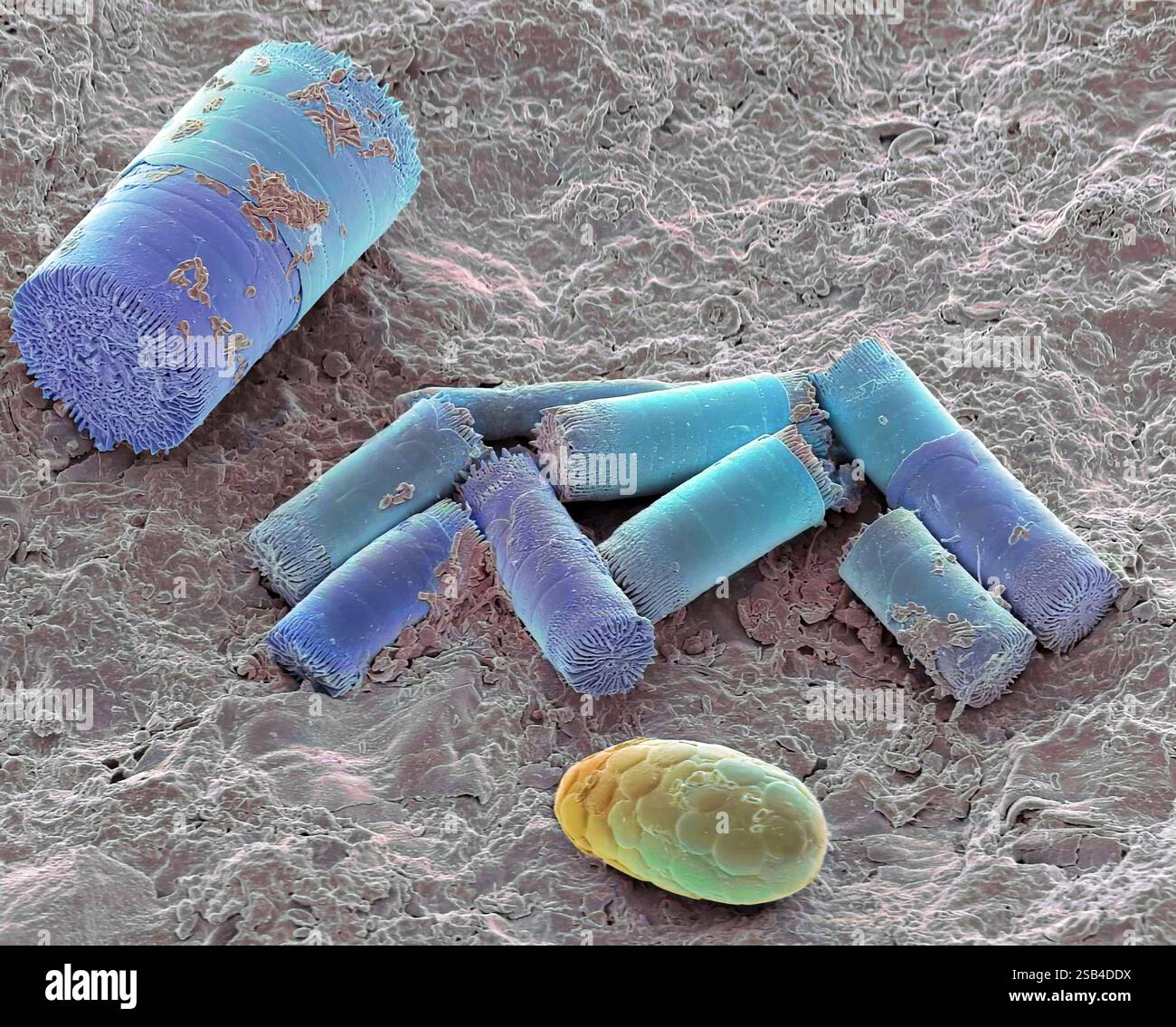 Soil diatoms, Coloured scanning electron micrograph (SEM). Although most diatom species occur in aquatic habitats, specific diatom communities occur in soil where they grow with other microalgae and cyanobacteria. In the soil food web, algae serve as food for soil protozoa and micro- and meio-fauna such as nematodes or collembolans. Present also is a shelled (testate) amoeba, single-celled (protozoan) organisms found in damp soil, leaf litter and pools. Magnification: x1600 when printed 10 centimetres wide. Stock Photo