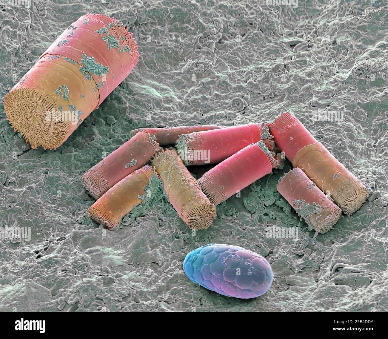 Soil diatoms, Coloured scanning electron micrograph (SEM). Although most diatom species occur in aquatic habitats, specific diatom communities occur in soil where they grow with other microalgae and cyanobacteria. In the soil food web, algae serve as food for soil protozoa and micro- and meio-fauna such as nematodes or collembolans. Present also is a shelled (testate) amoeba, single-celled (protozoan) organisms found in damp soil, leaf litter and pools. Magnification: x1600 when printed 10 centimetres wide. Stock Photo