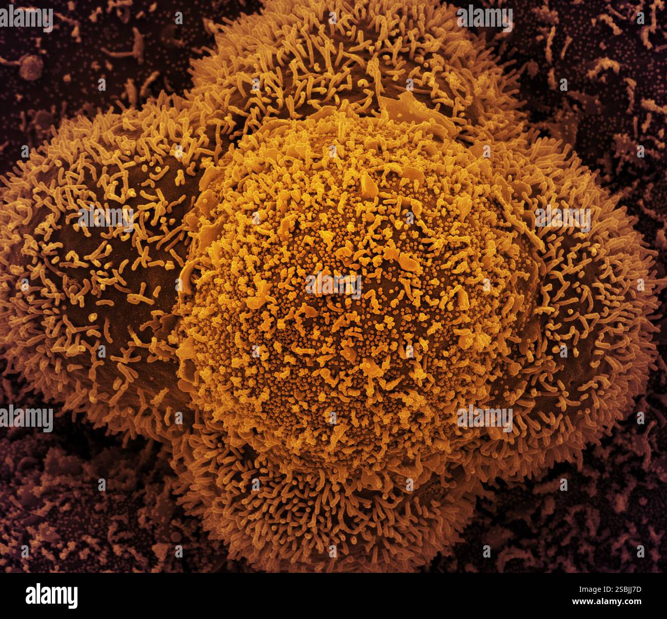 String Virus CCL-81 cells heavily infected with SARS-CoV-2 virus particles. The ...