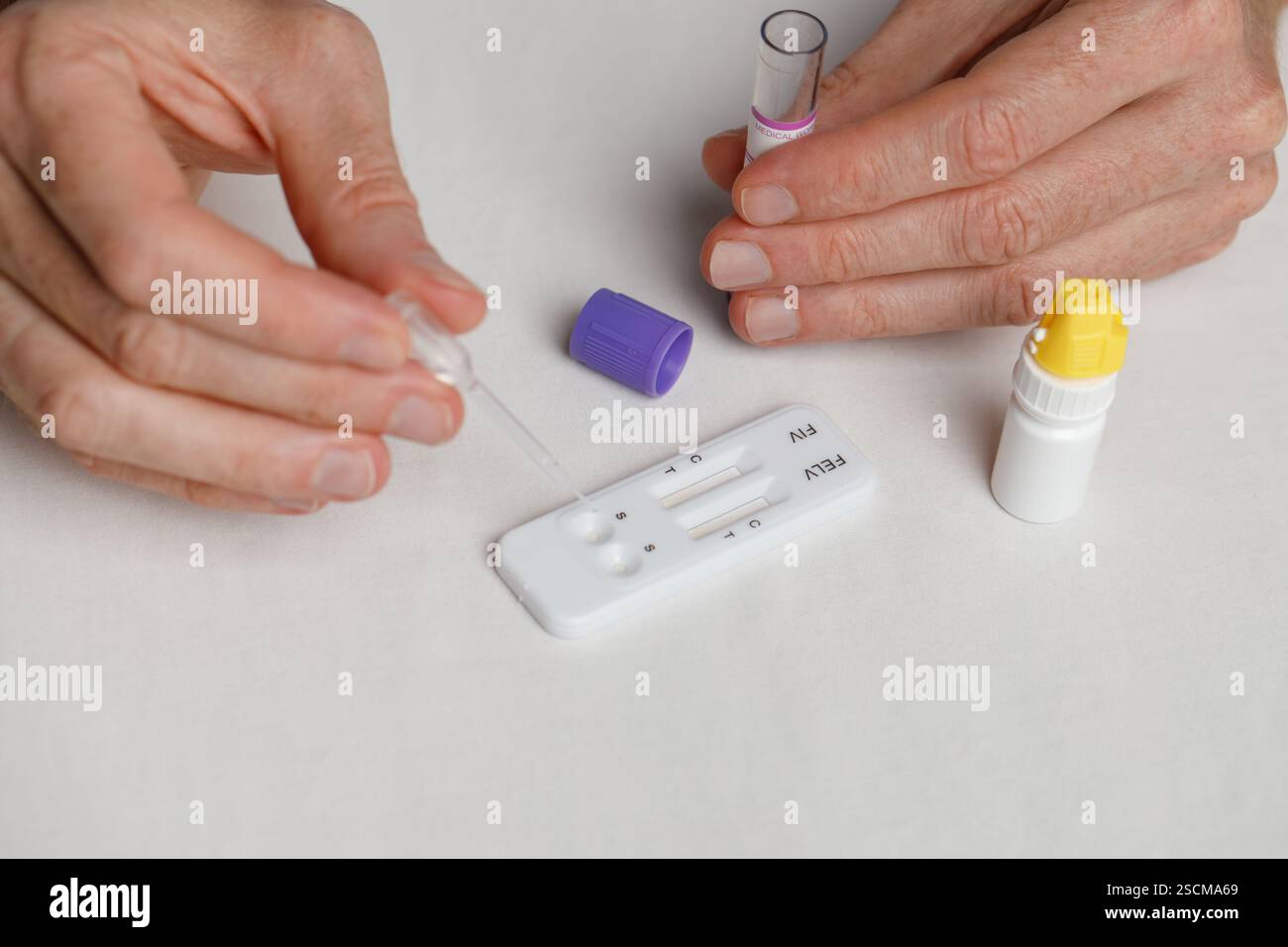 View of Veterinarian doctor making rapid test for detection of feline leukemia ...