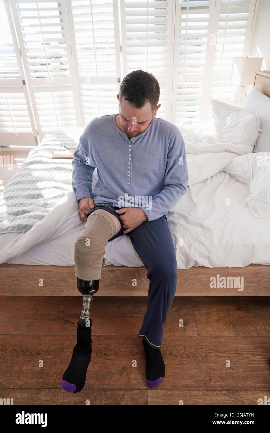 Man attaching leg prosthesis Stock Photo