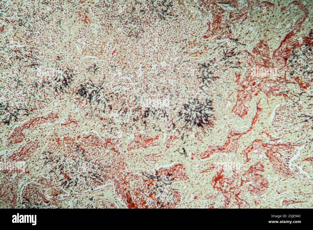 Novolin Rsebum Under Microscope Yeast under microscope hi-res stock photography and images - Alamy