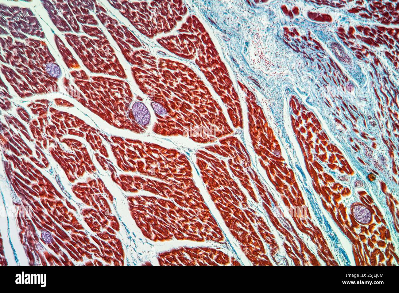 Tapeworm parasite in muscle 100x Stock Photo