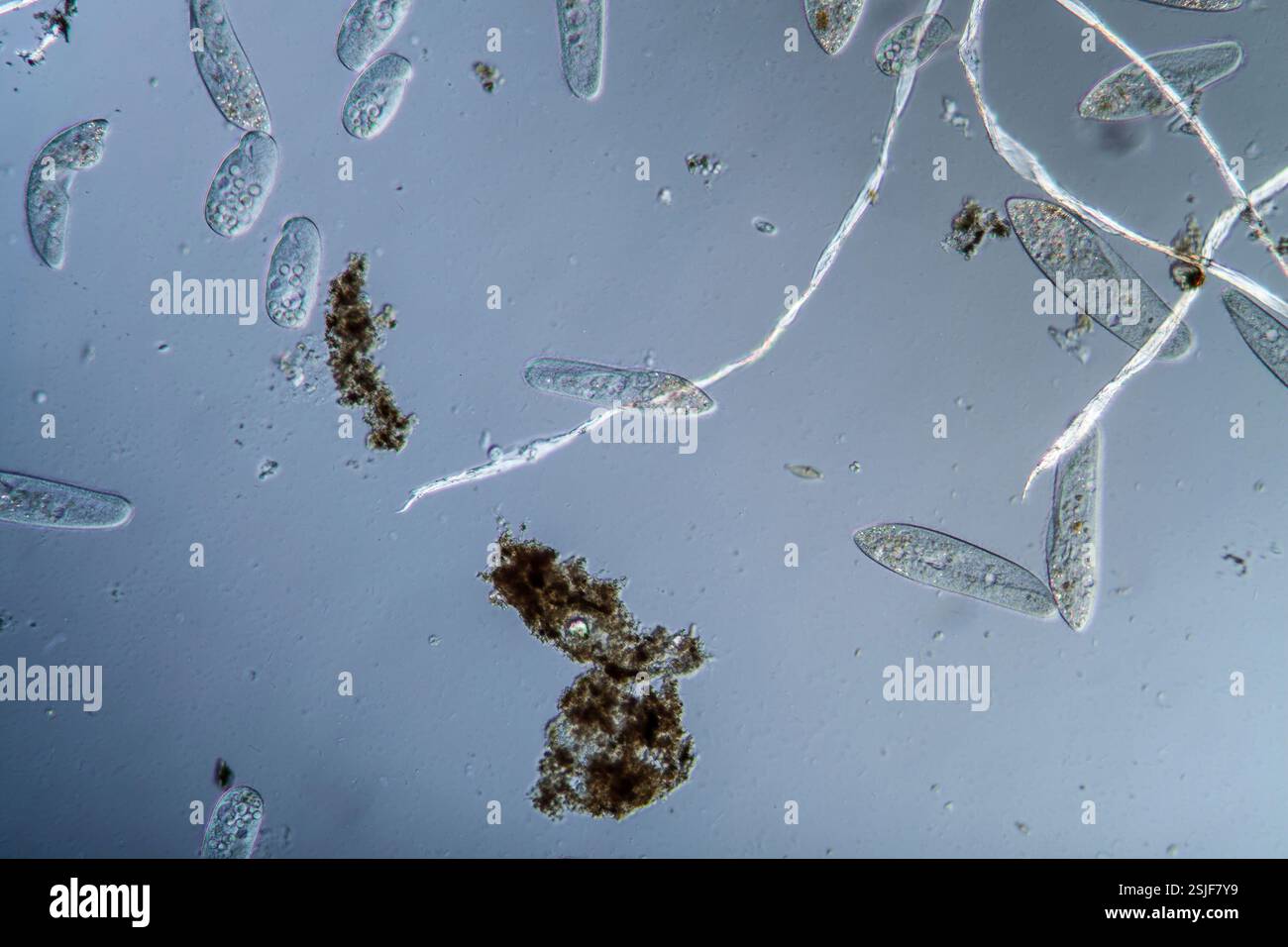 Plankton with ciliates Stock Photo