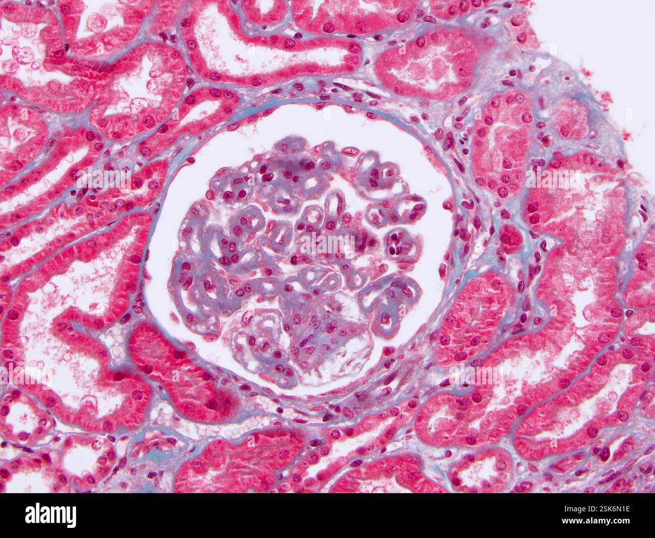 What Damages Kidney Function