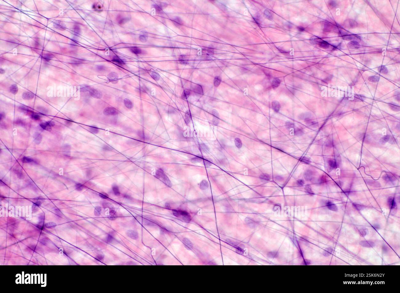 Loose connective tissue. Light micrograph of loose, or areolar ...
