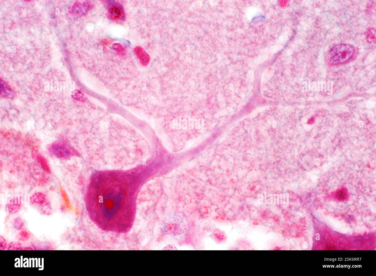 Purkinje nerve cell. Light micrograph of a purkinje nerve cell (bottom ...