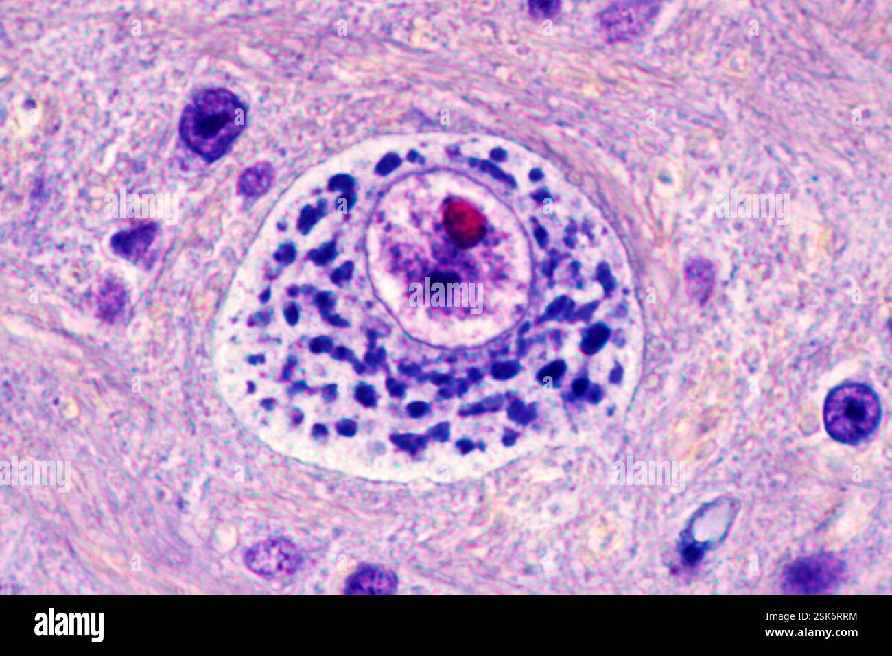 Motor neurone. Light micrograph of a section through a motor neurone ...
