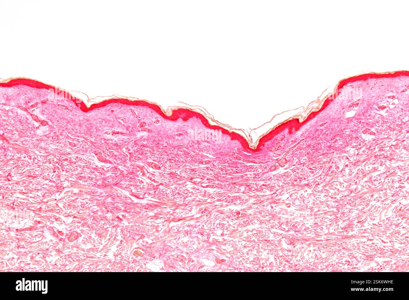 Light micrograph of a skin section in a Caucasian (white) person ...