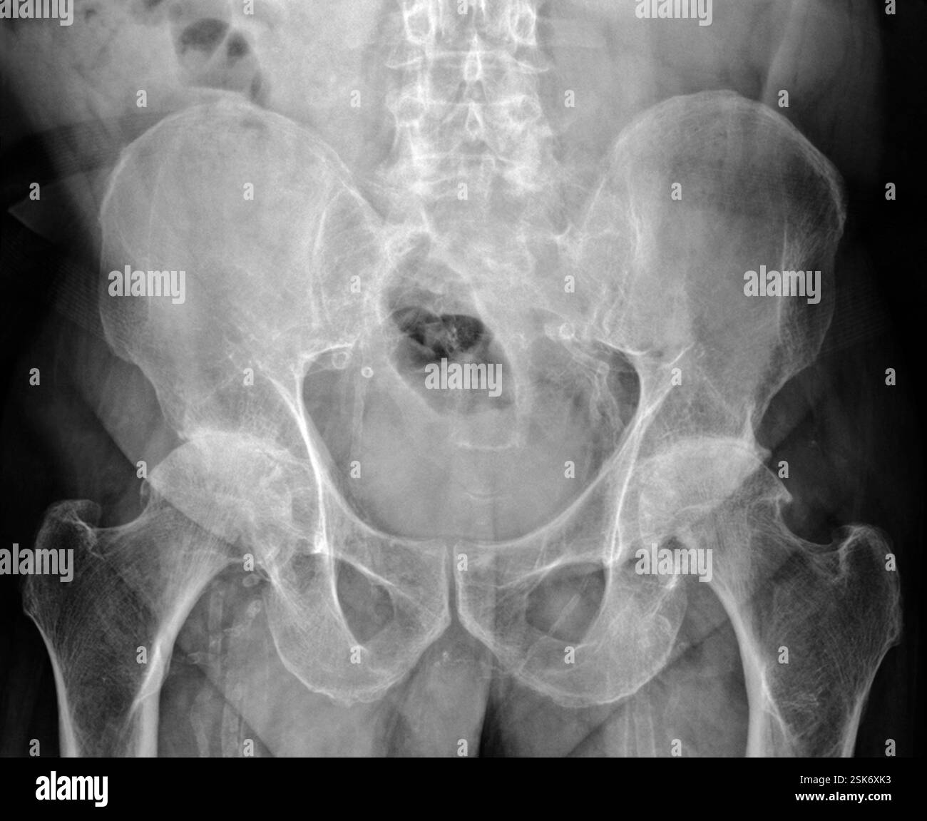 Head, brain and pituitary gland, MRI scan Stock Photo - Alamy