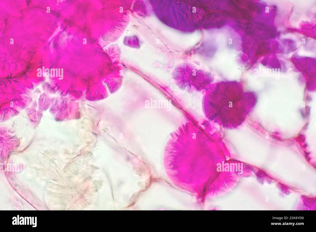 Inulin plant tuber polysaccharide crystals, light micrograph. Inulin is ...