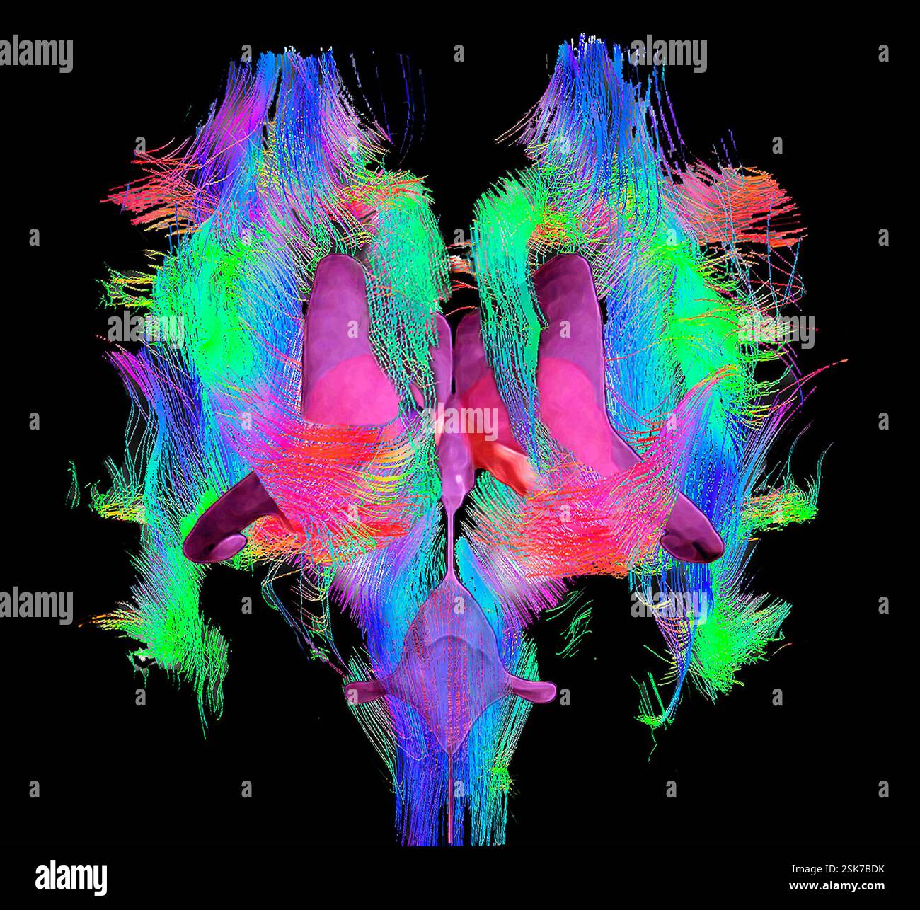 Brain fibres and structures. 3D diffusion tensor imaging (DTI) magnetic ...