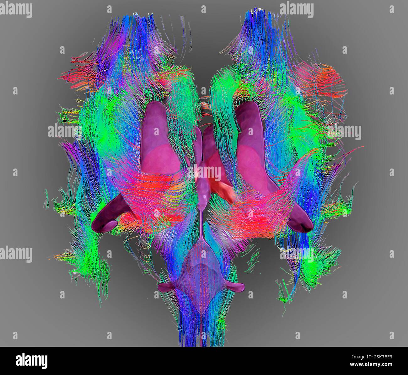 Brain fibres and structures. 3D diffusion tensor imaging (DTI) magnetic ...