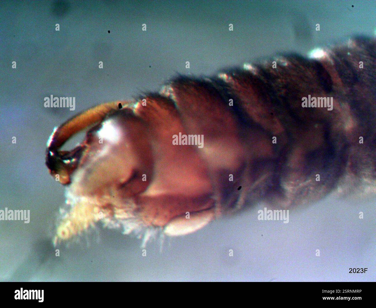 Posterior abdomen hi-res stock photography and images - Alamy