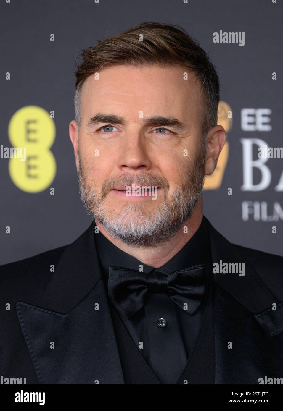 gary barlow förmögenhet - Ilustrasi 3