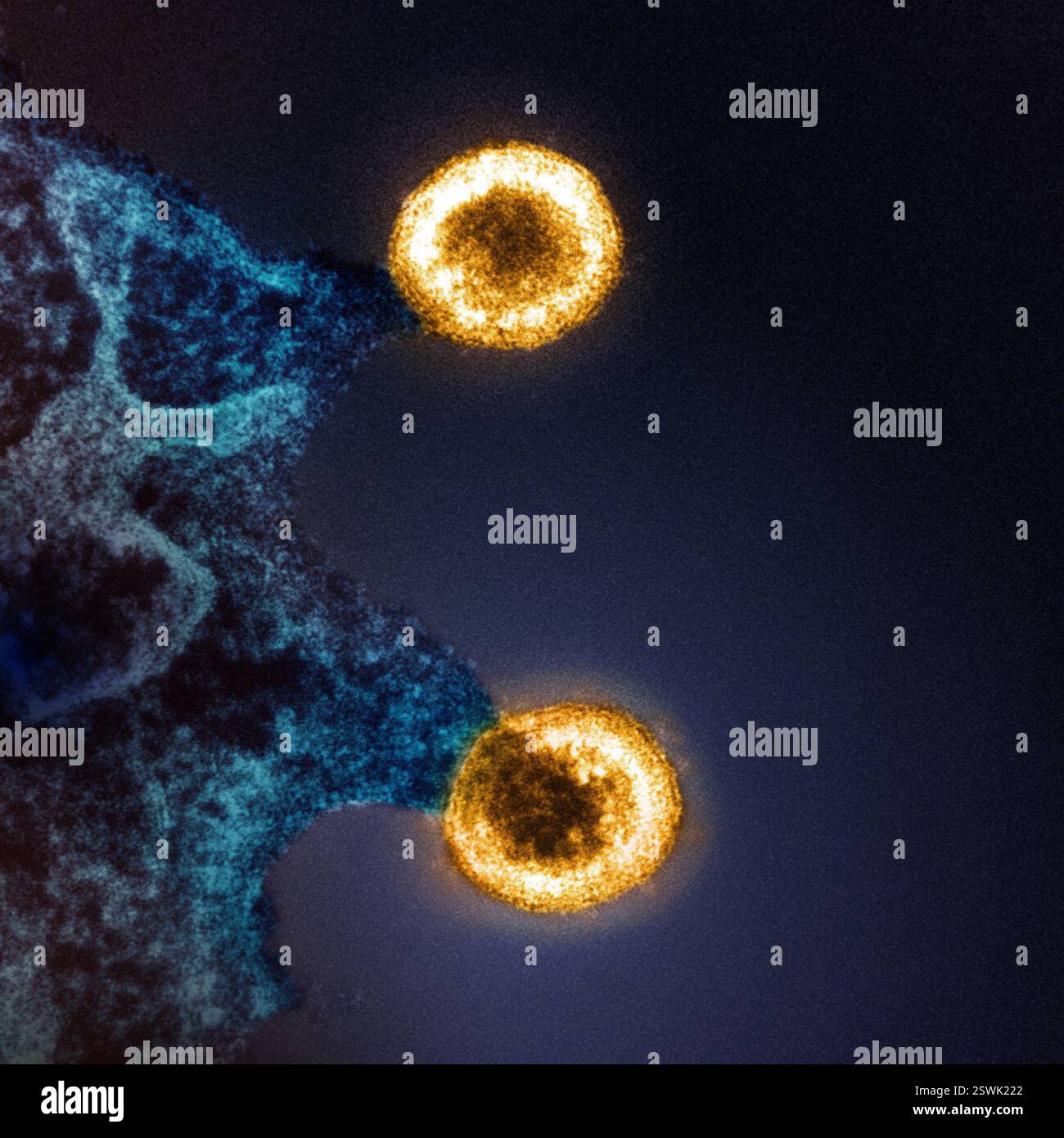 Colorized transmission electron micrograph of two HIV-1 virus particles (yellow) budding from the plasma membrane of an infected H9 T cell (blue). Image captured at the NIAID Integrated Research Facility (IRF) in Fort Detrick, Maryland. Stock Photo