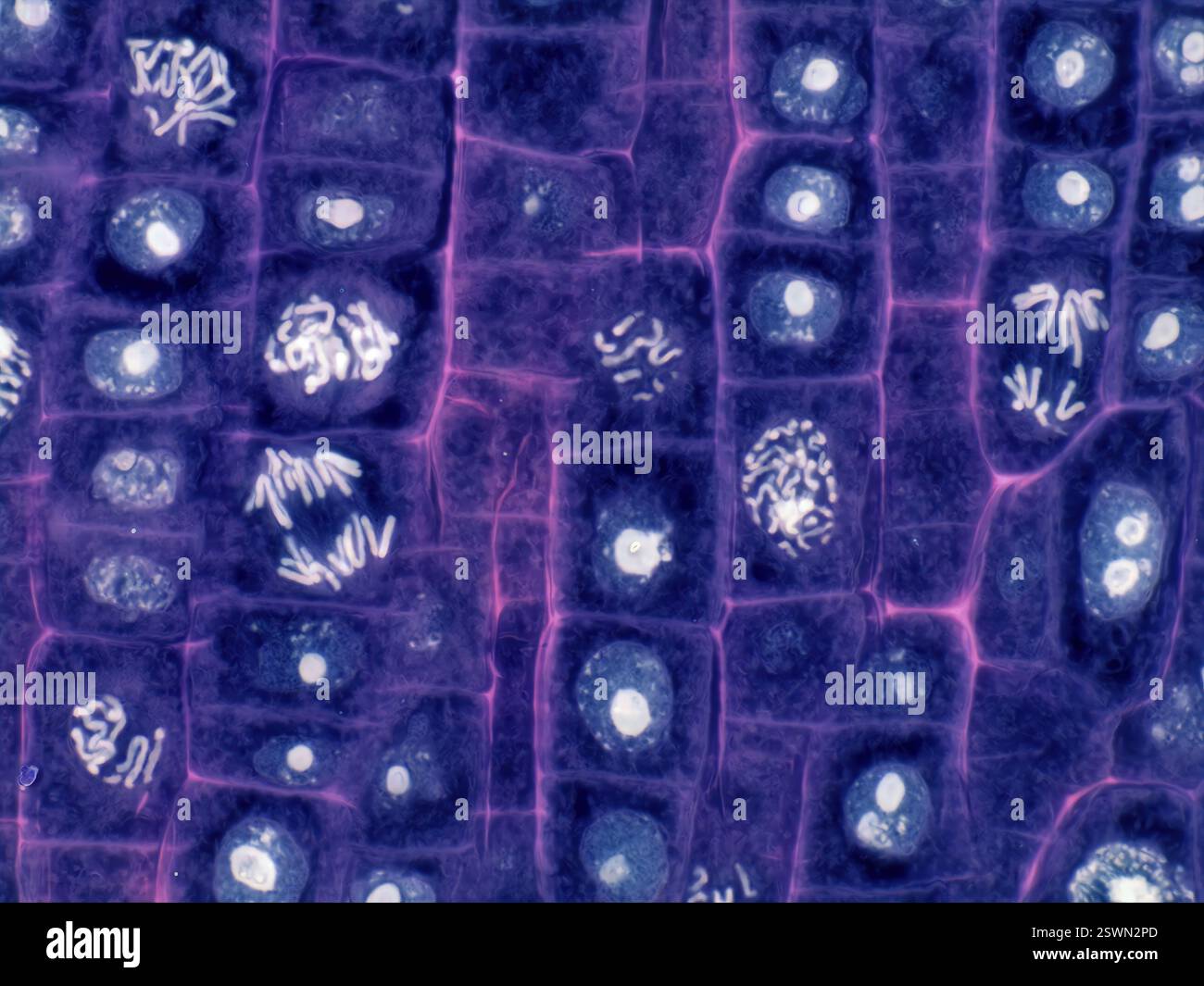 Plant Cell Mitosis Light Micrograph Of Root Tip Cells From An Onion 