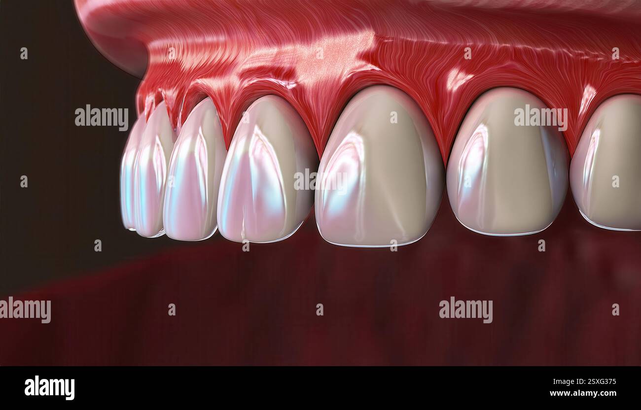 This artistic representation highlights teeth and gums, emphasizing ...