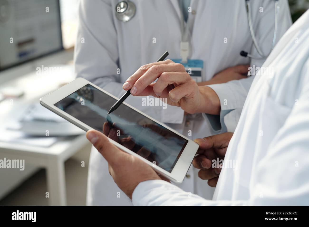Chest x ray images hi-res stock photography and images - Alamy