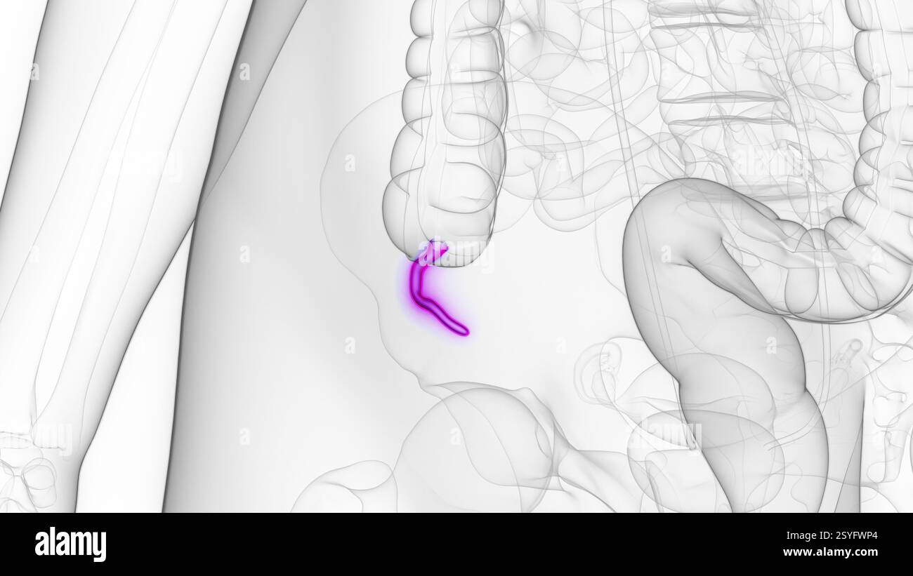 Female appendix, illustration Stock Photo - Alamy