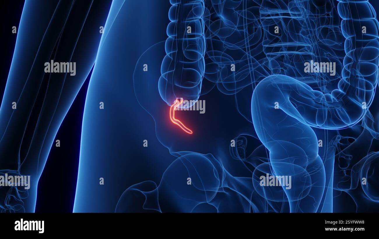 Female appendix, illustration Stock Photo - Alamy