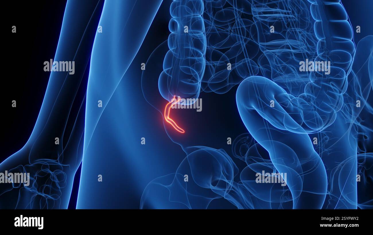 Female appendix, illustration Stock Photo - Alamy
