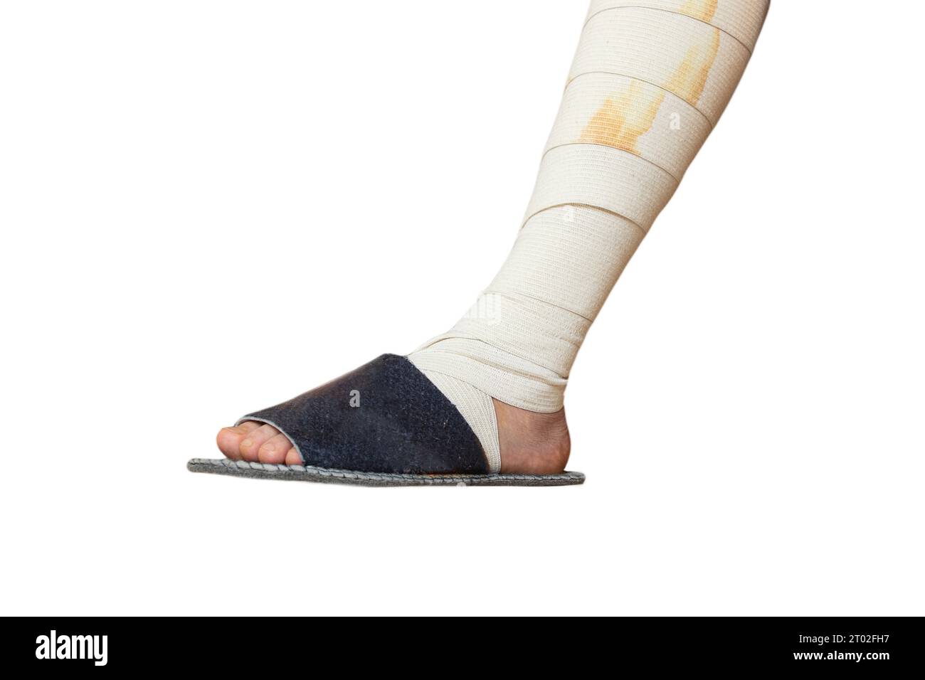 One male leg bandaged with an elastic bandage after knee surgery in