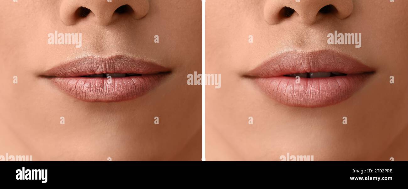 Операциядан кейінгі транссексуалдың суреті