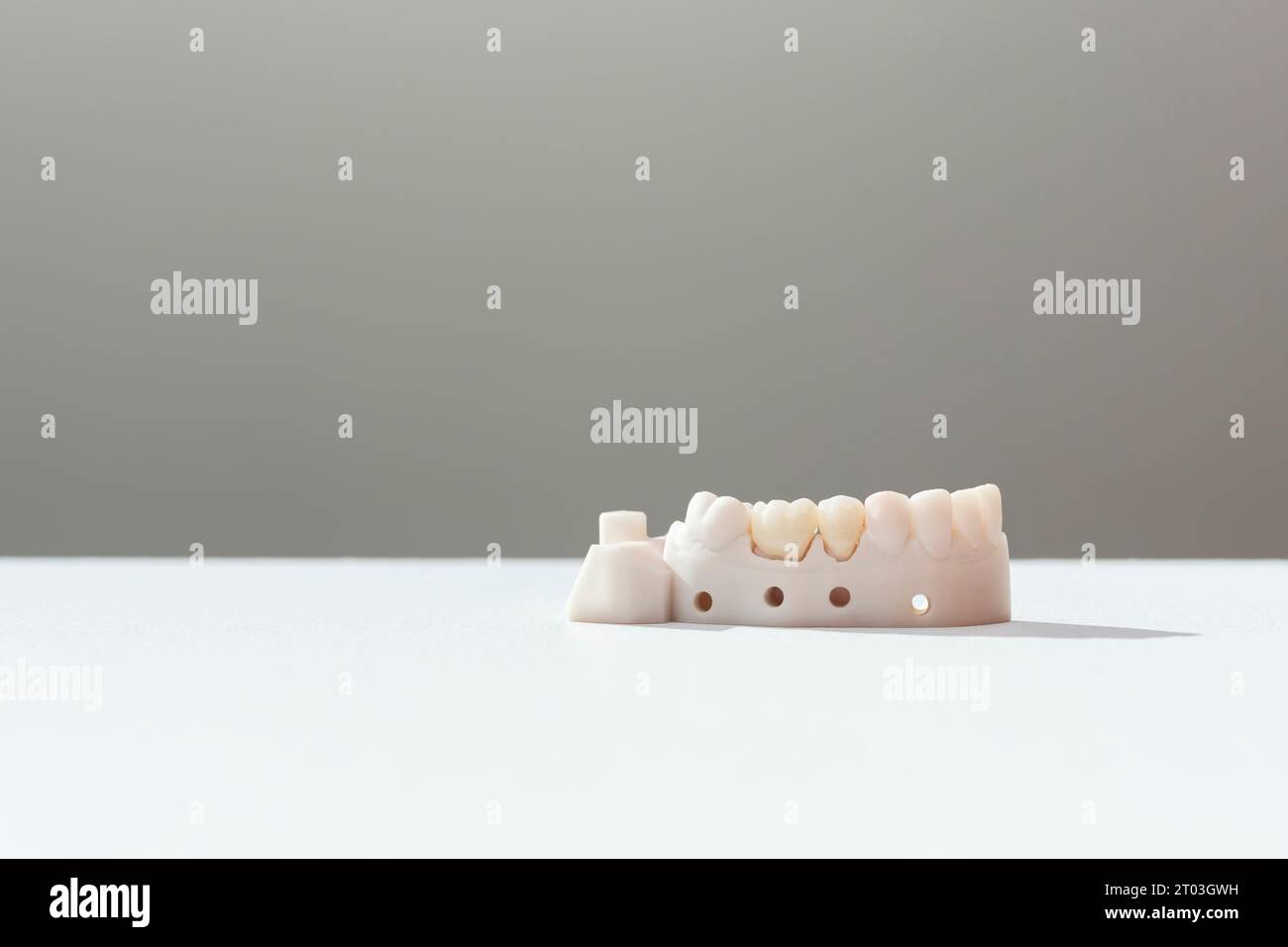 Teeth Crowns And Bridge Equipment Model Shows Fix Restoration