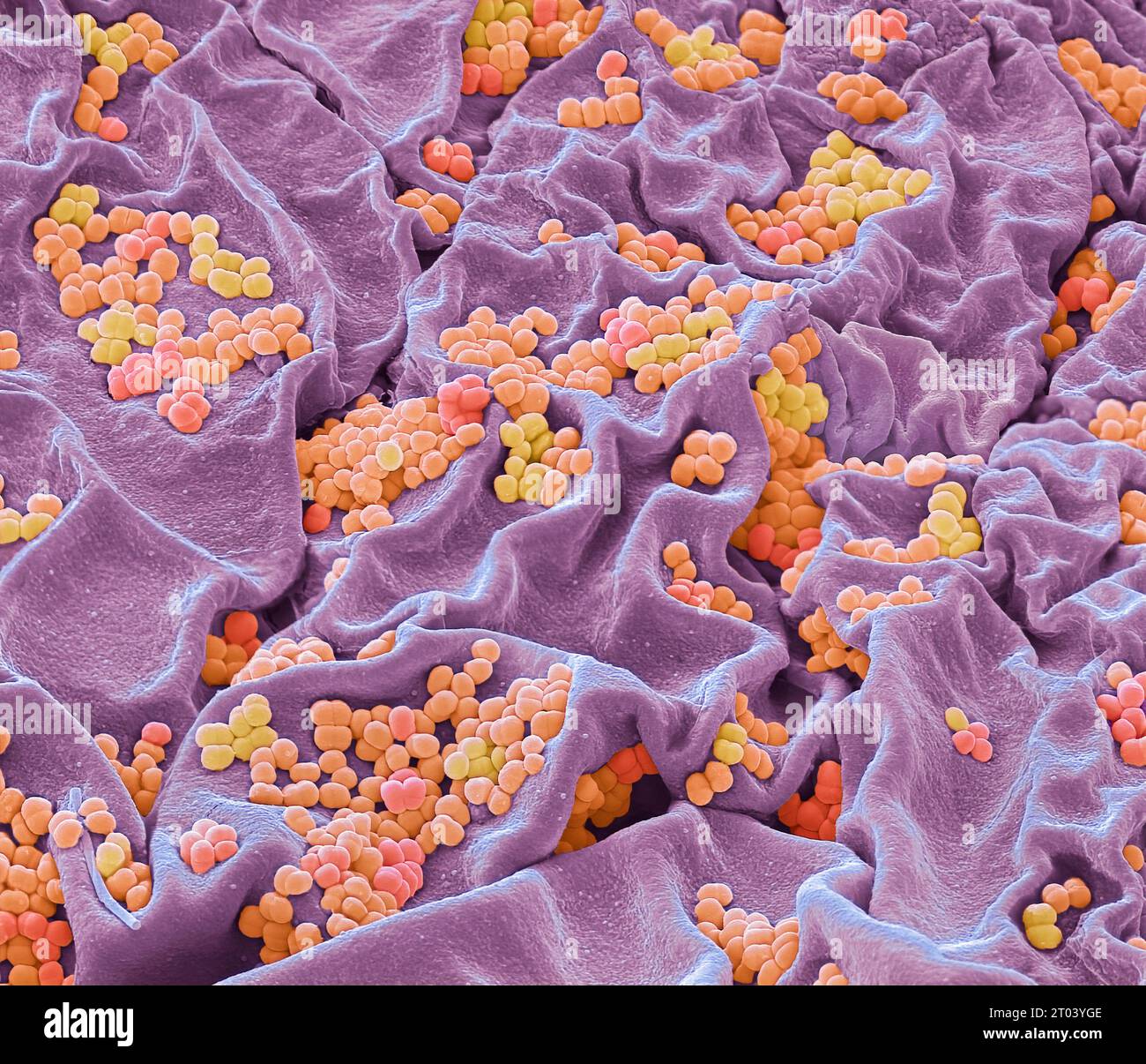 Skin bacteria. Coloured scanning electron micrograph (SEM) of bacteria ...