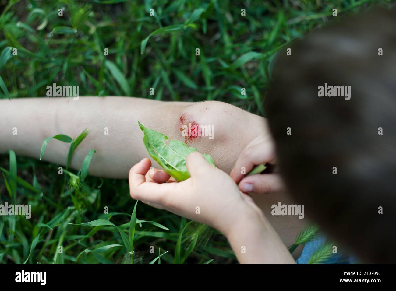 Closeup of fresh bleeding wound on child knee due to fall. child applies plantain leaf to wound. Children injuries in summer outdoors. Phytotherapy, f Stock Photo