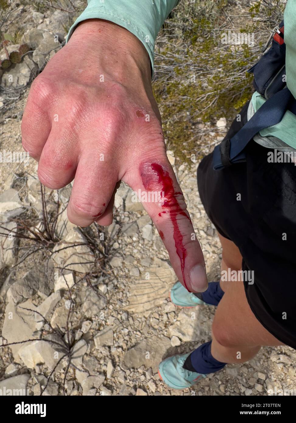 Hiker Shows Bloody Finger In The Desert after it got cut open on a cactus Stock Photo