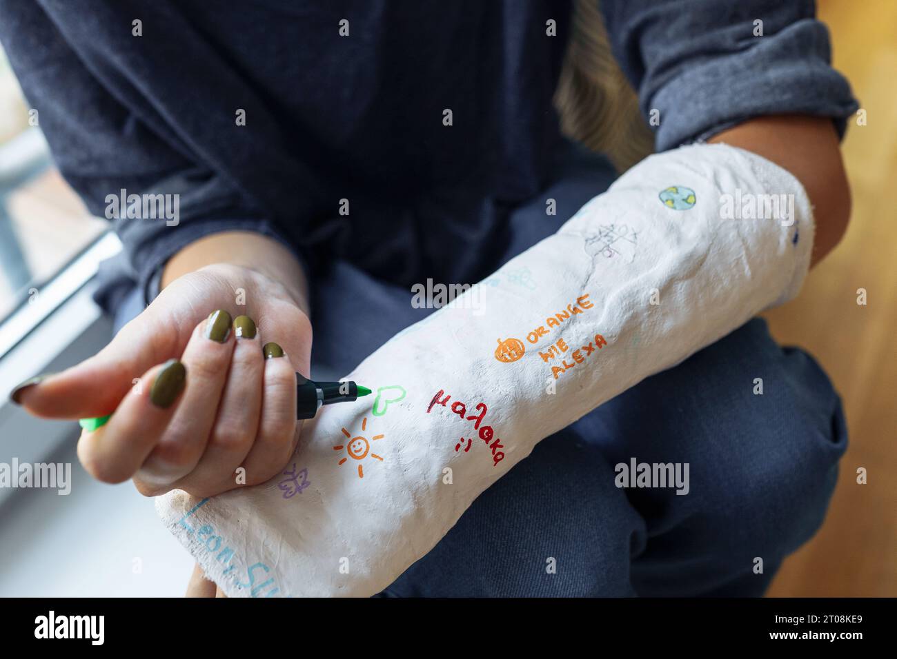 Broken arm cast funny hires stock photography and images Alamy