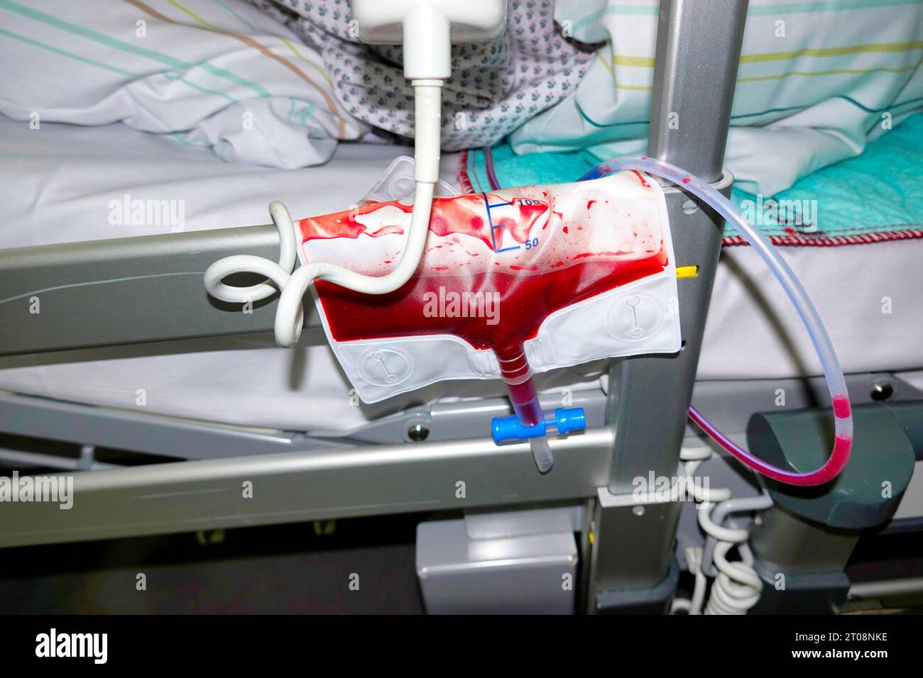 Applied wound drain slowly fills with blood and wound fluid, hospital