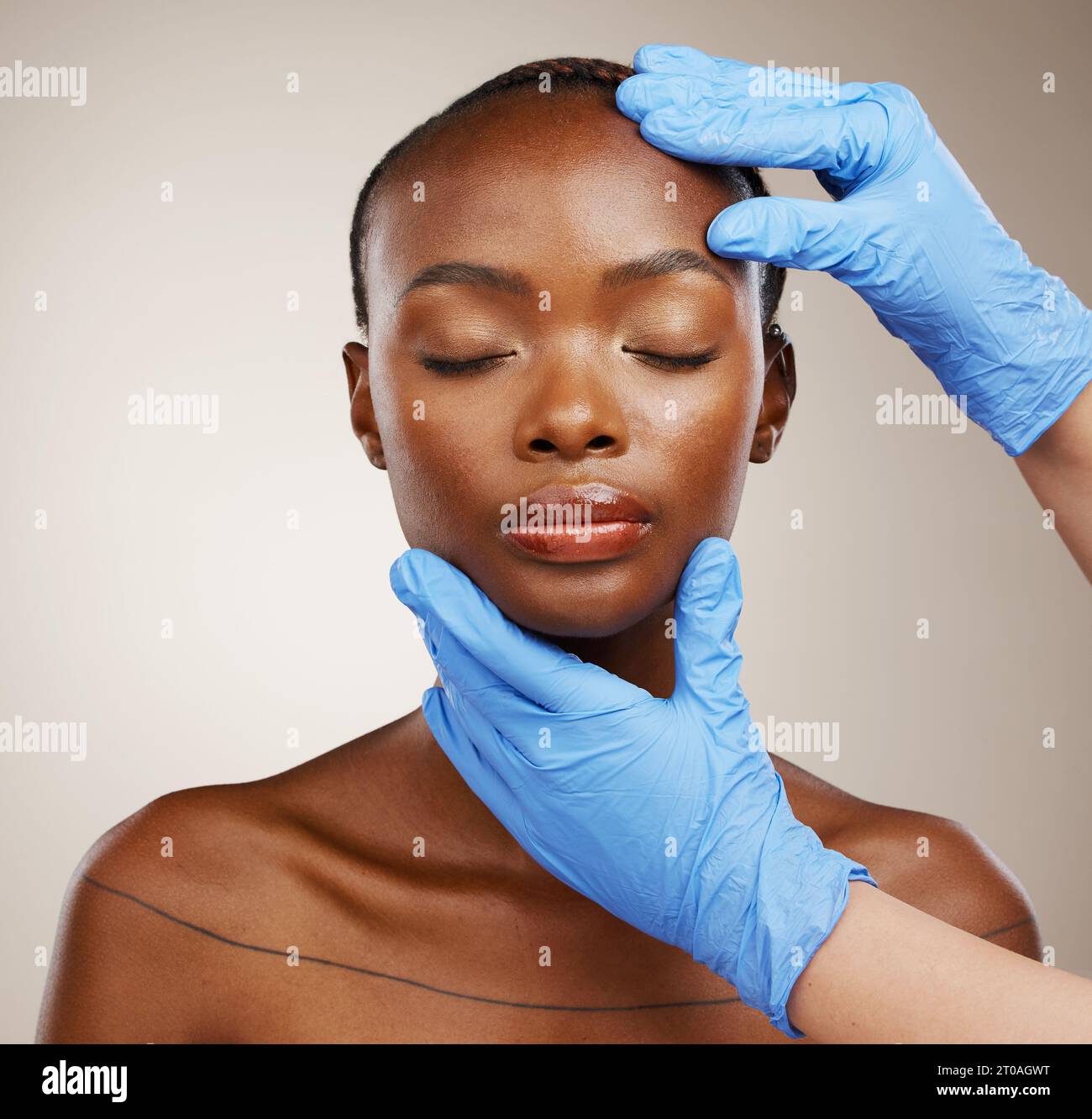 Portrait, hands and botox with a black woman patient in studio on a ...