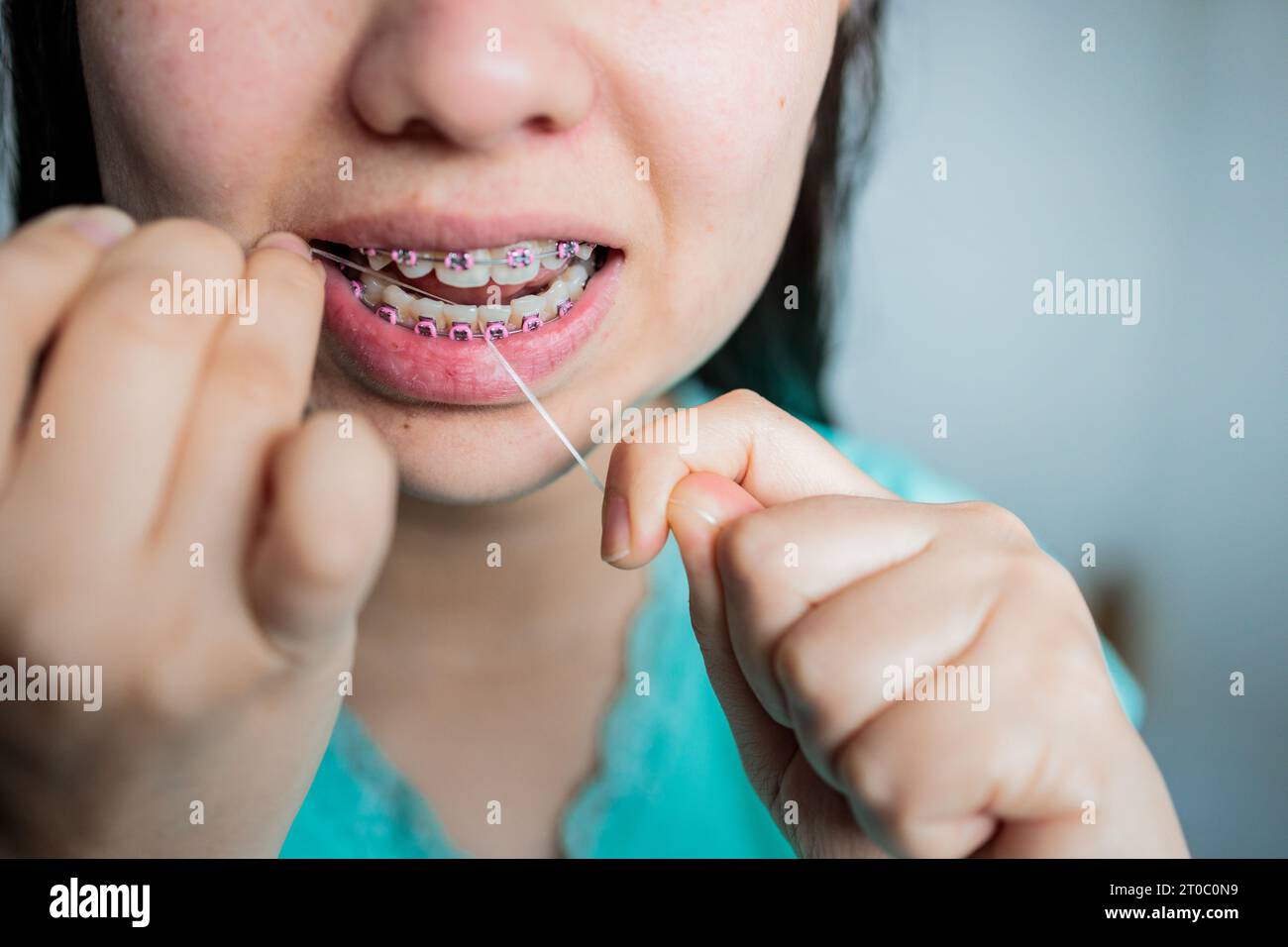 Young Girl with Braces Doing Oral Hygiene Routine by Using Dental Floss