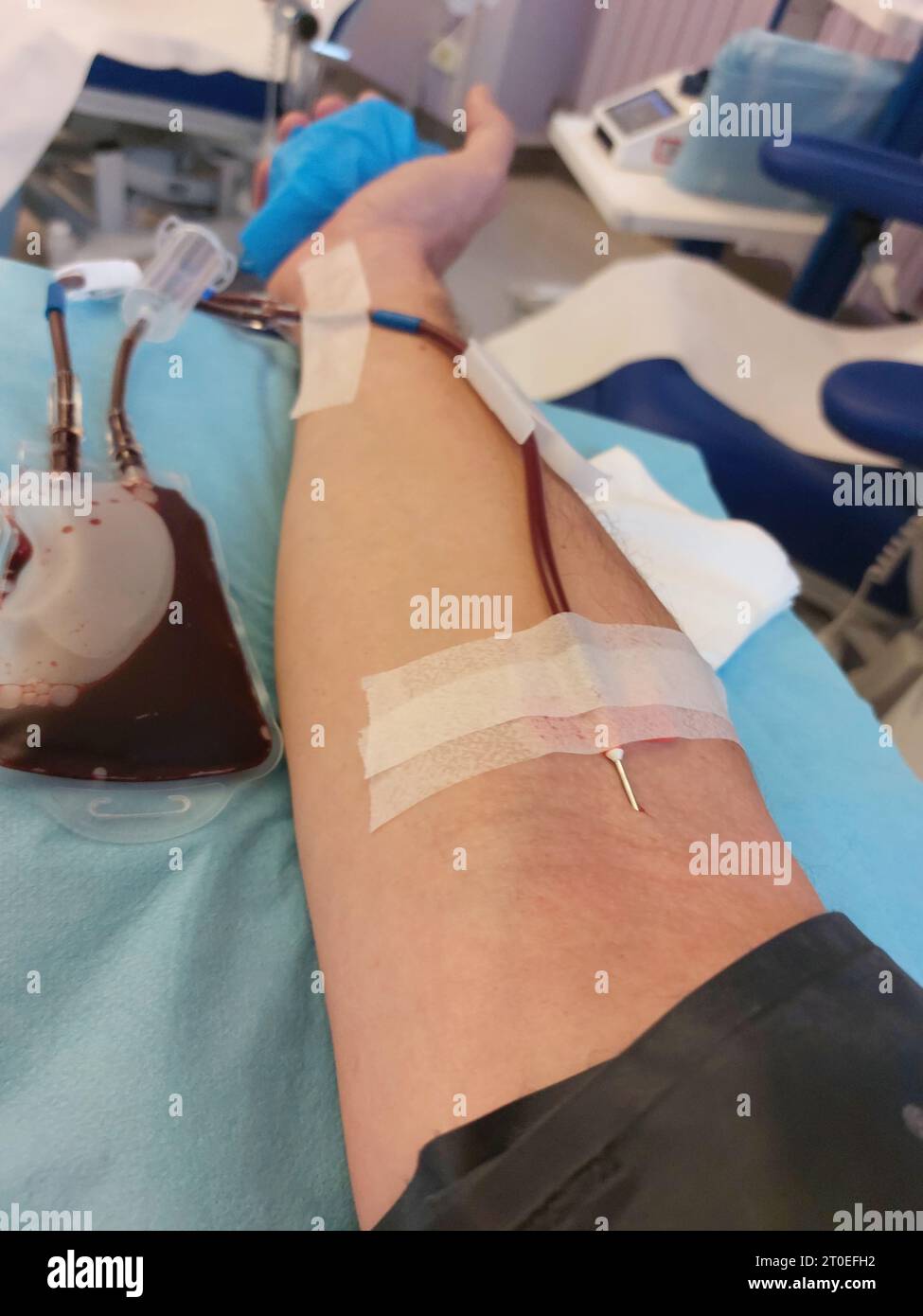 Arm of Man on hospital bed with needle stuck in forearm during medical