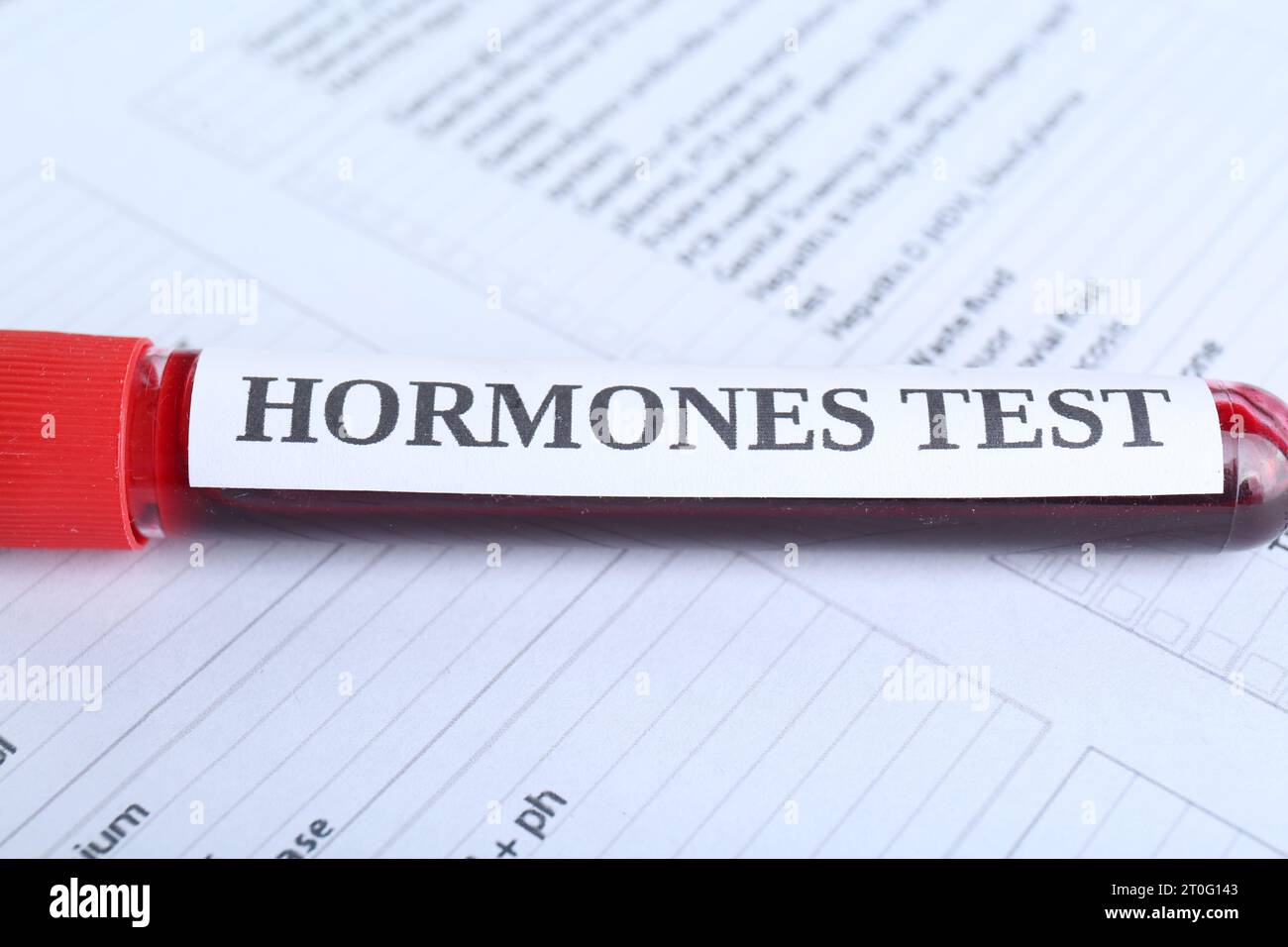 Hormones test. Sample tube with blood on laboratory form, closeup Stock