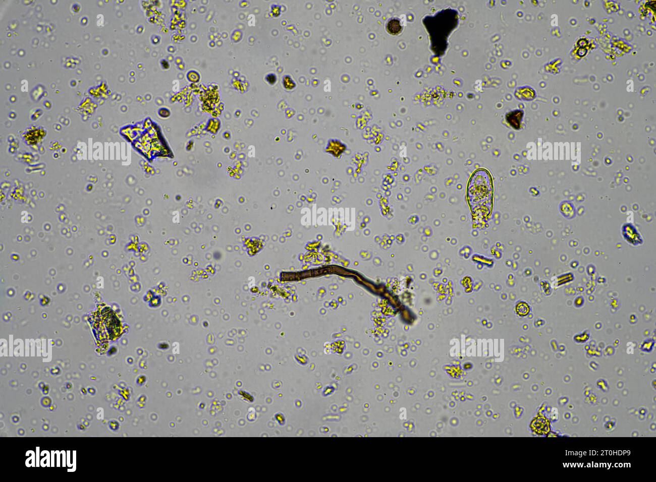 Microorganisms and biology in Compost and soil sample under the ...