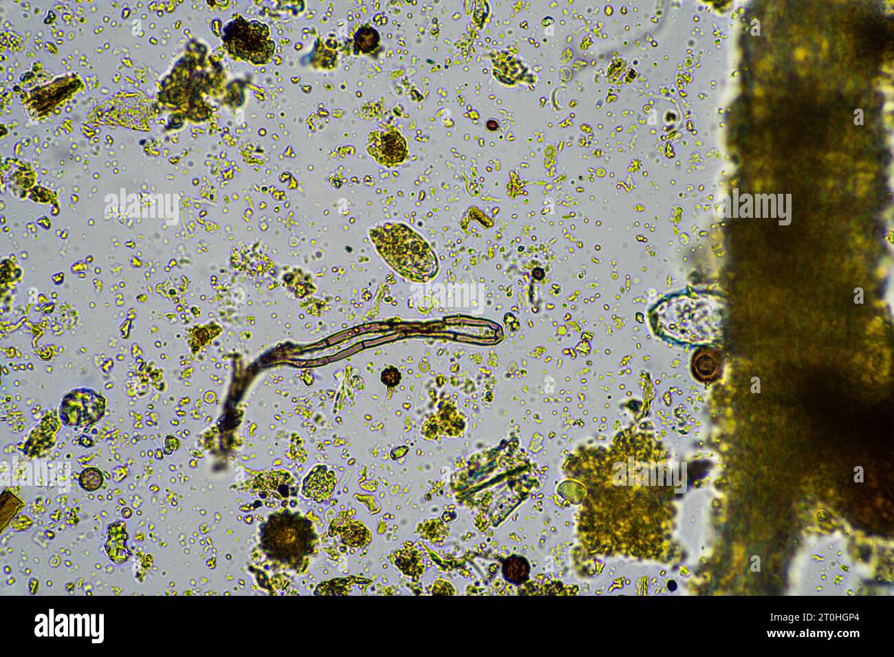 Microorganisms and biology in Compost and soil sample under the ...