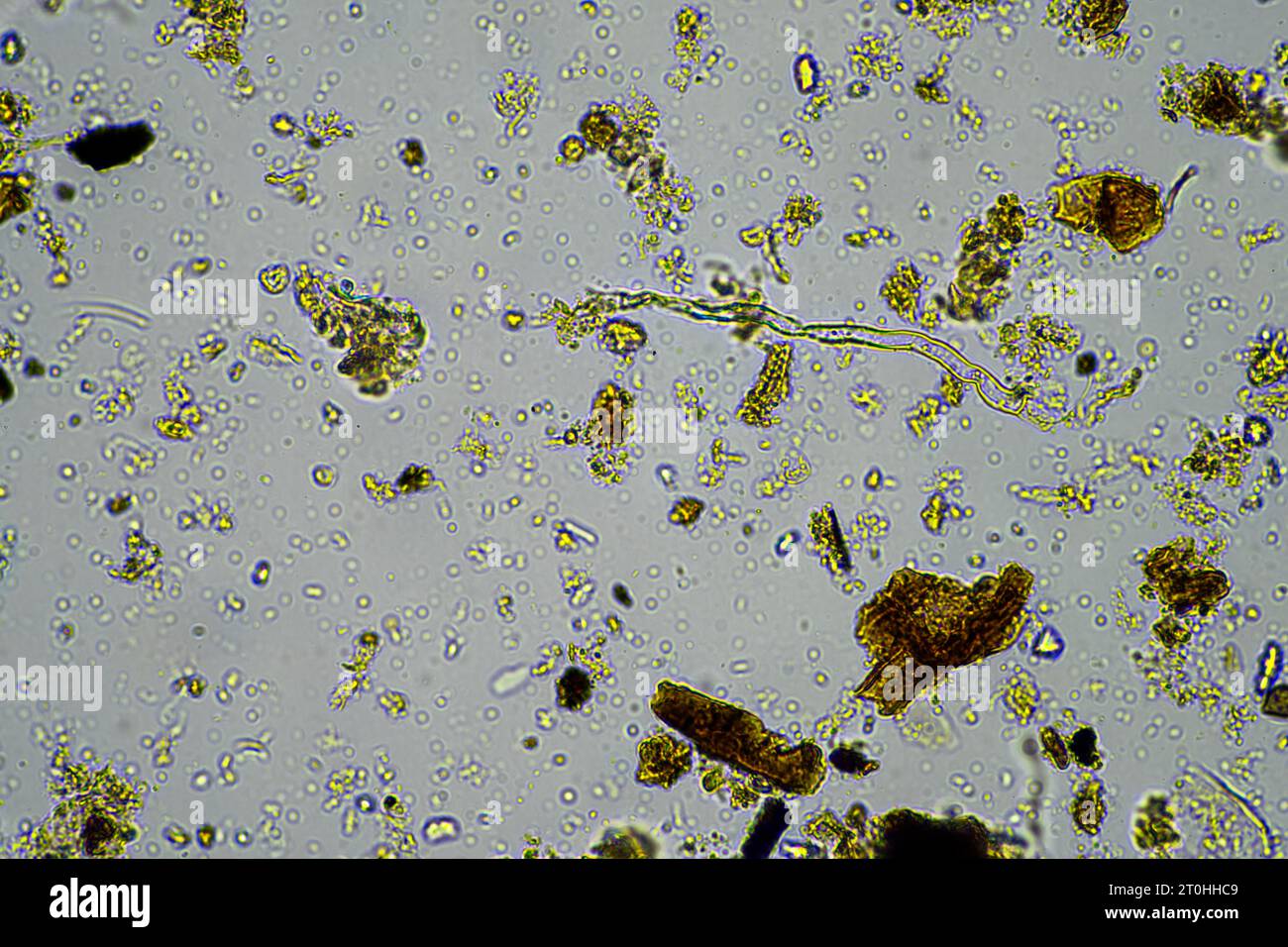 Microorganisms and biology in Compost and soil sample under the ...