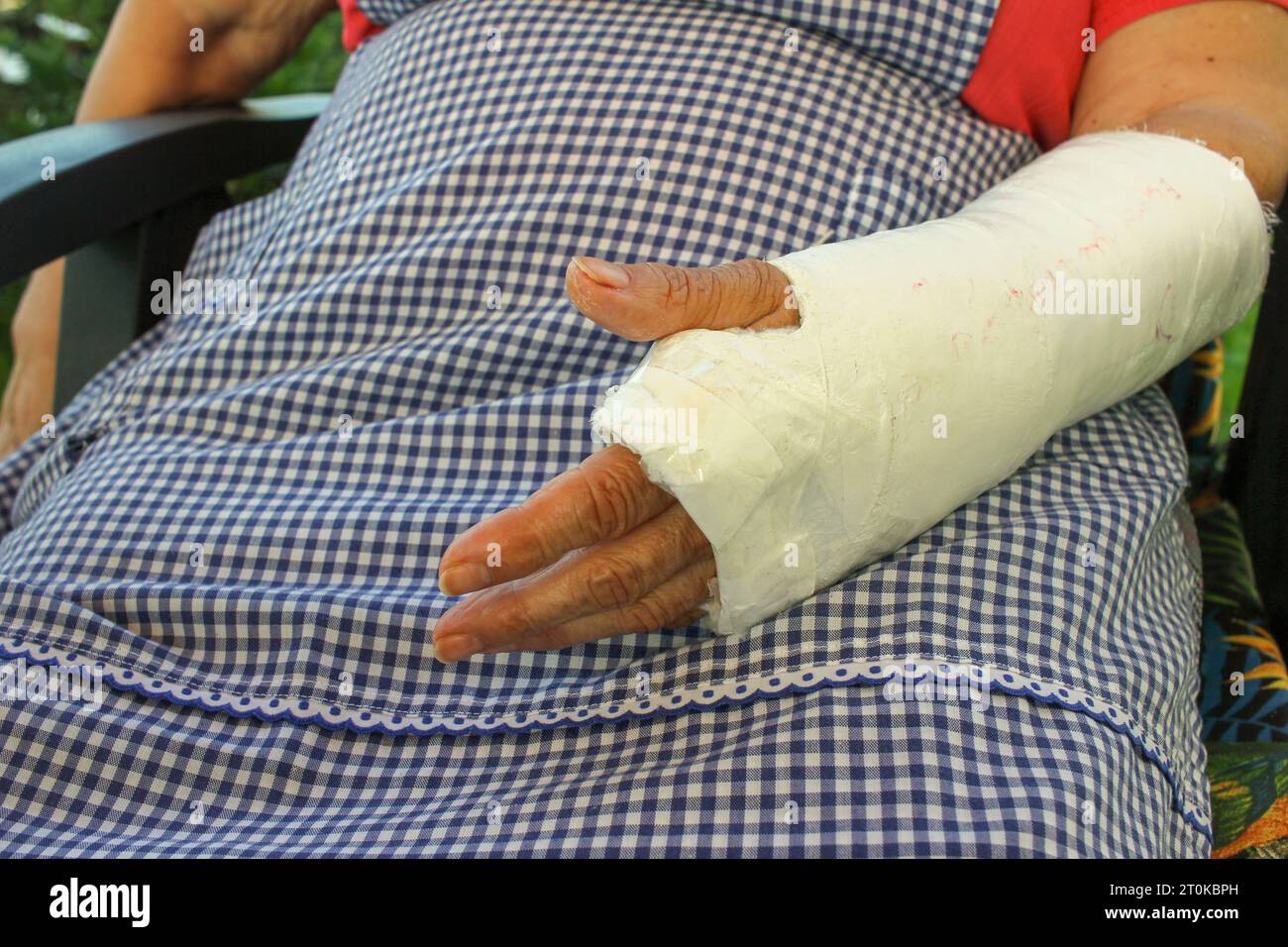 old woman with an arm in a cast in her garden Stock Photo Alamy