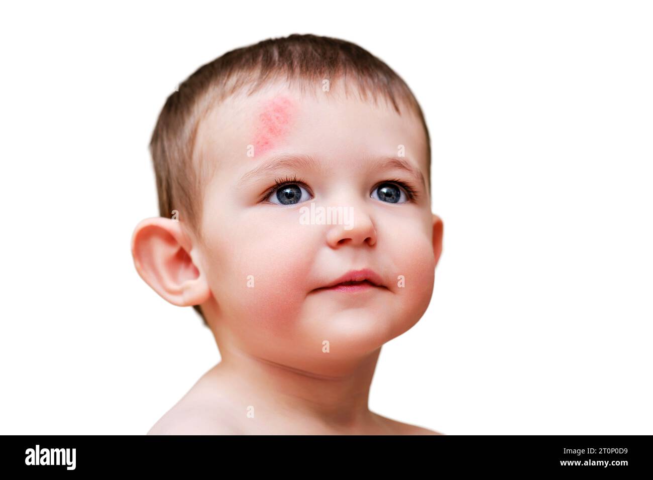 Toddler baby face with scratch on forehead, isolated on white