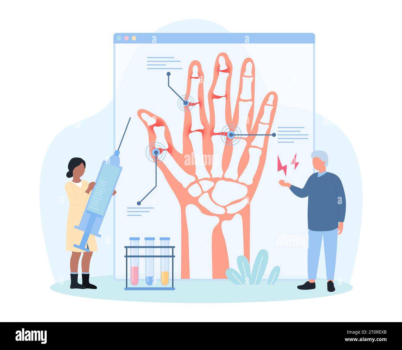 Diagnosis and treatment of arthritis vector illustration. Cartoon tiny