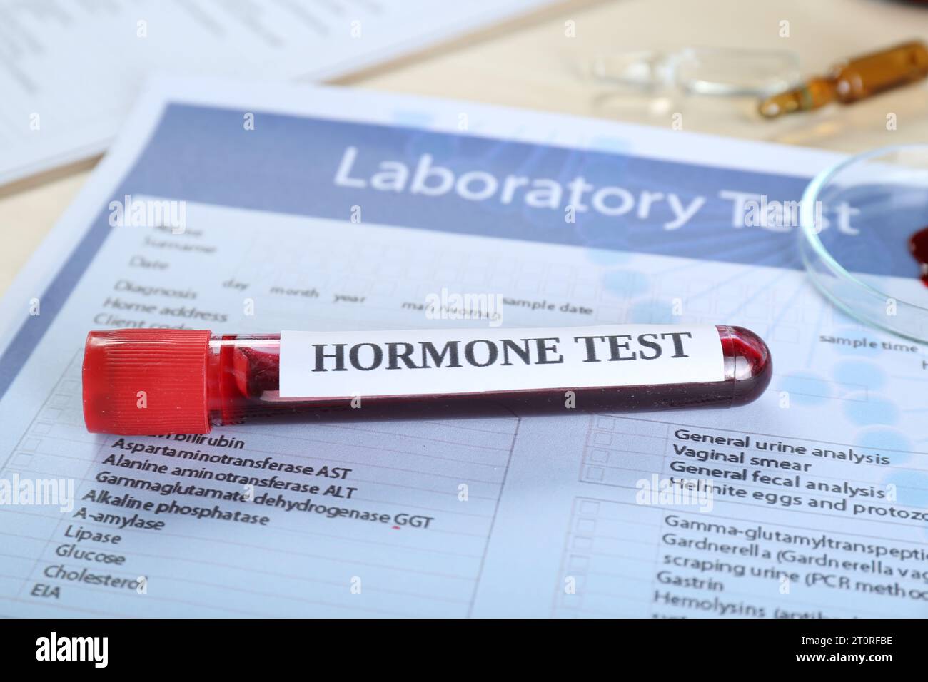Hormones test. Sample tube with blood on laboratory form, closeup Stock