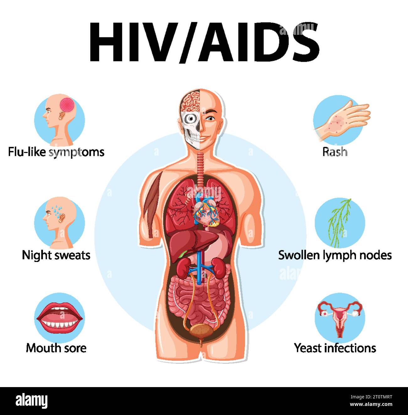 Illustrated Infographic Depicting The Impact Of HIV AIDS On The Body s 